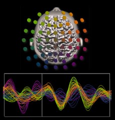 5-D image of brain